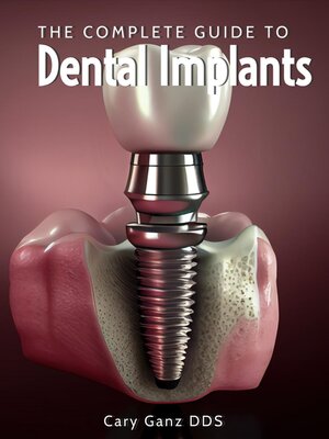 cover image of The Complete Guide to Dental Implants